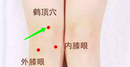 杏林早报 | 天凉膝盖痛？从这2个方向调理，逼走寒湿，远离“老寒腿”(图5)